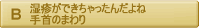 湿疹ができちゃったんだよね。手首のまわり